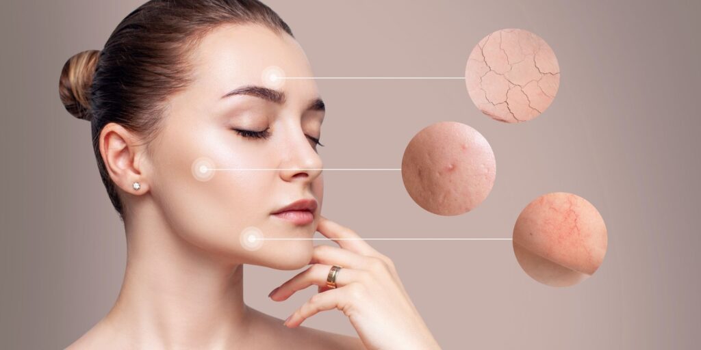 Effektive Hautpflege bei Rosacea